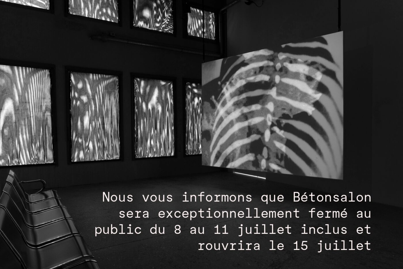 Surexposée, comme aux rayons X - Bétonsalon